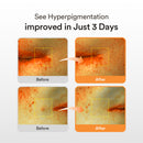 Abib, Serum Dark Spot Glutathiosome Vita Drop, 50ml