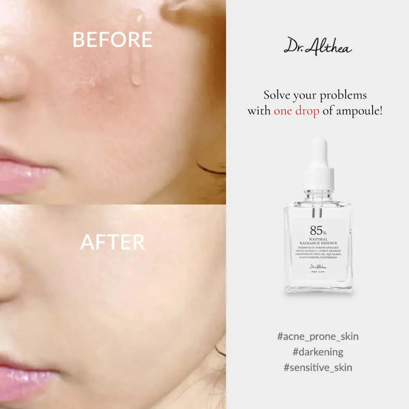 Dr. Althea, Essence Natural Radiance, 30ml