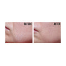 Haruharu WONDER, Toner hyaluronique au riz noir, Sans Parfum Sans Alcool, 150 ml