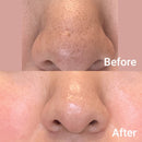 medicube, Pads Zero Pore 2.0, 70 pcs