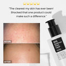 Cosrx, Toner BHA 4% + Niacinamide 2% Blackhead Power Liquid (acide salicylique), 100 ml